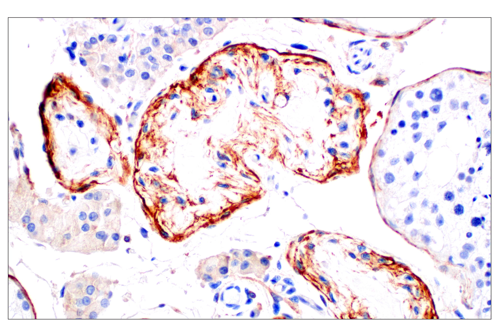 Immunohistochemistry Image 6: Neuropilin-2 (E5Q2G) Rabbit mAb (BSA and Azide Free)