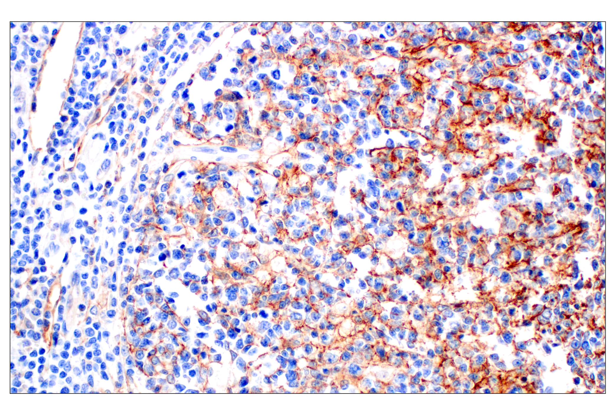 Immunohistochemistry Image 4: Neuropilin-2 (E5Q2G) Rabbit mAb (BSA and Azide Free)