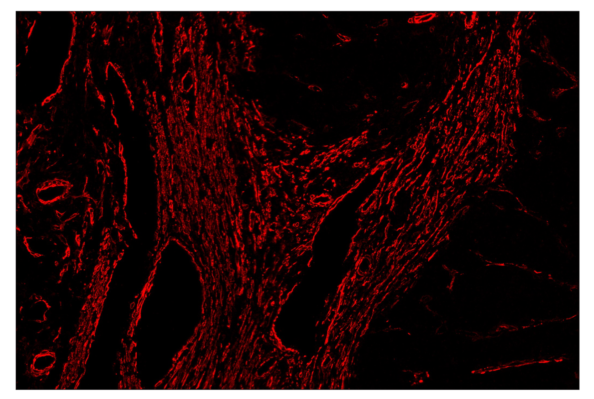 Immunohistochemistry Image 4: α-Smooth Muscle Actin (D4K9N) & CO-0024-488 SignalStar™ Oligo-Antibody Pair