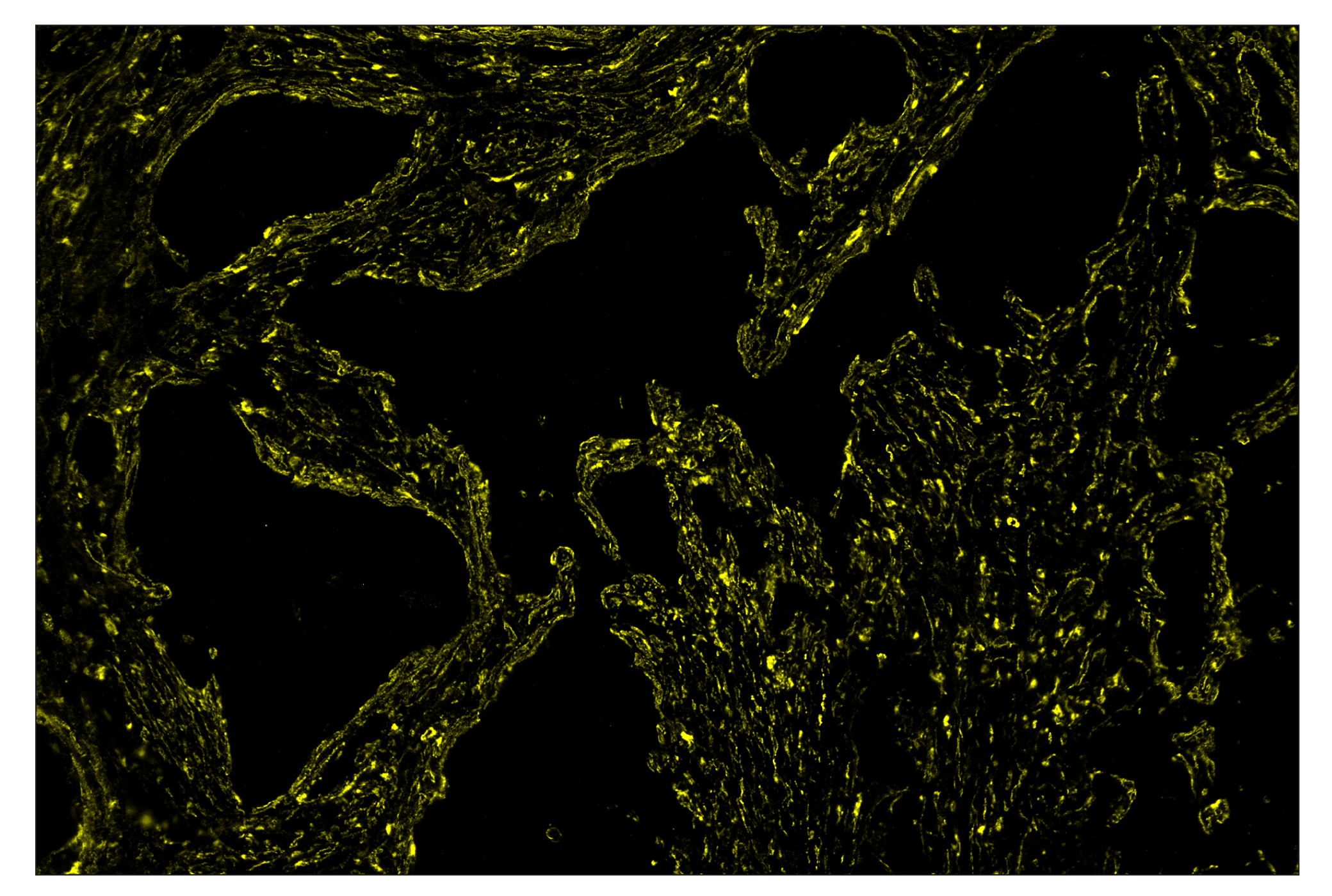 Immunohistochemistry Image 3: α-Smooth Muscle Actin (D4K9N) & CO-0024-750 SignalStar™ Oligo-Antibody Pair