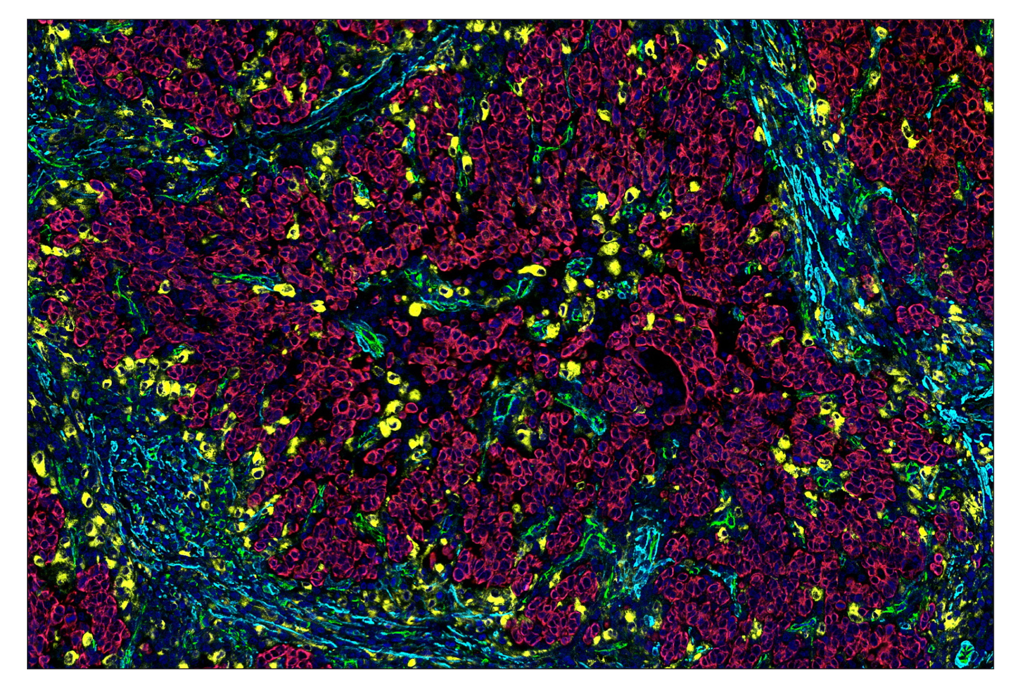 Immunohistochemistry Image 1: α-Smooth Muscle Actin (D4K9N) & CO-0024-647 SignalStar™ Oligo-Antibody Pair