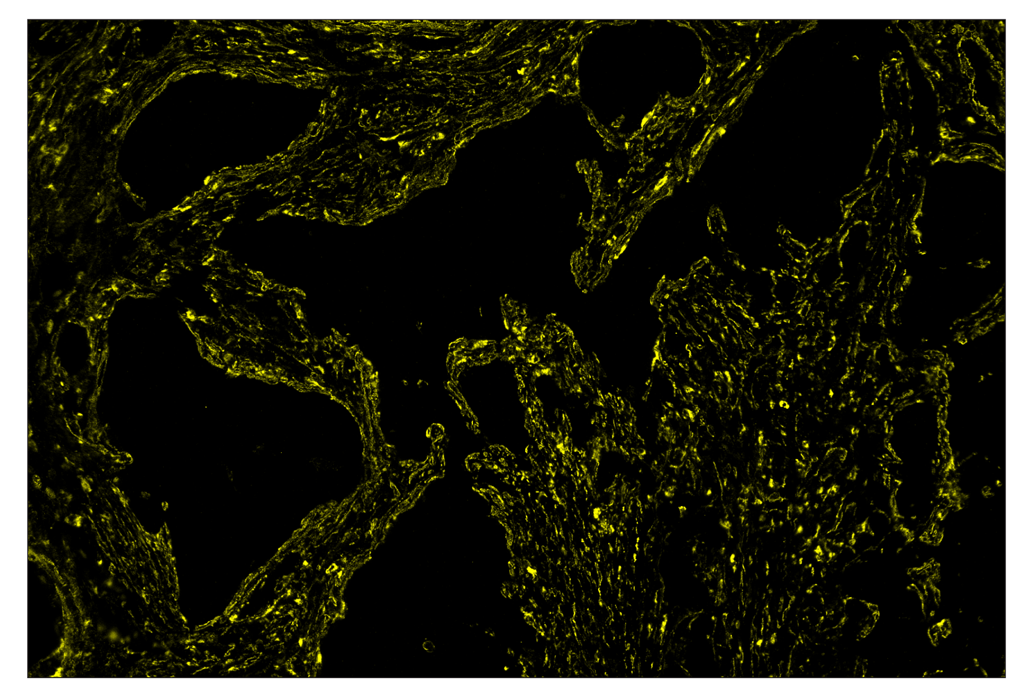 Immunohistochemistry Image 4: α-Smooth Muscle Actin (D4K9N) & CO-0024-594 SignalStar™ Oligo-Antibody Pair