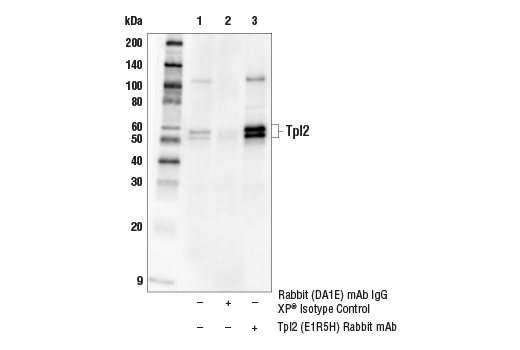 Immunoprecipitation Image 1: Tpl2 (E1R5H) Rabbit mAb