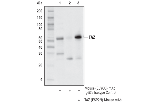 Immunoprecipitation Image 1: TAZ (E5P2N) Mouse mAb