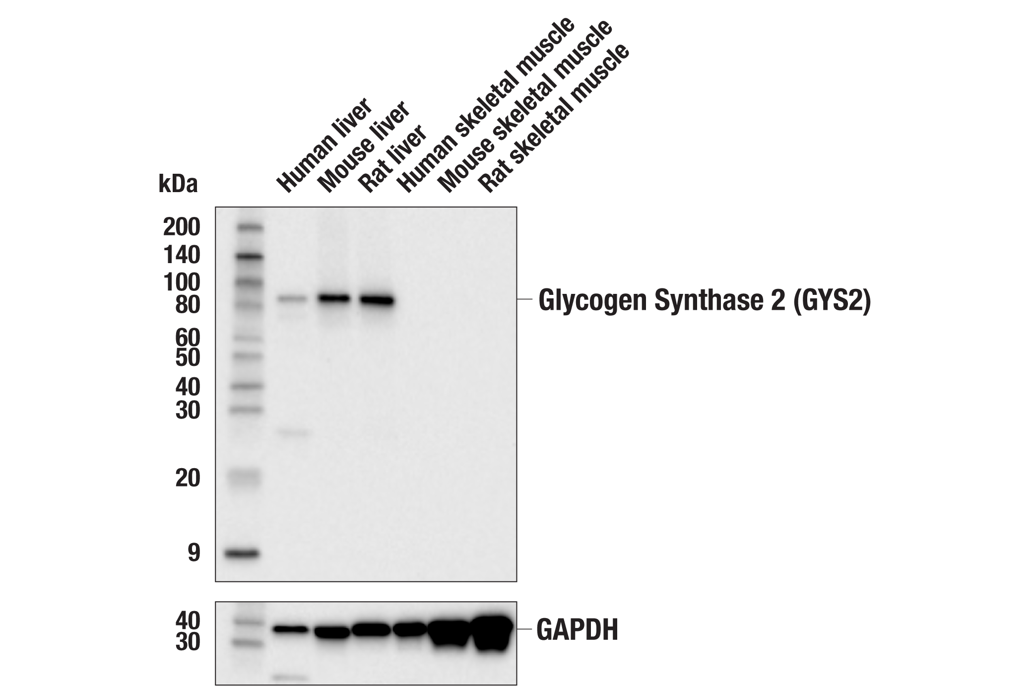 Western Blotting Image 1: Glycogen Synthase 2 (GYS2) (E5E4V) Rabbit mAb