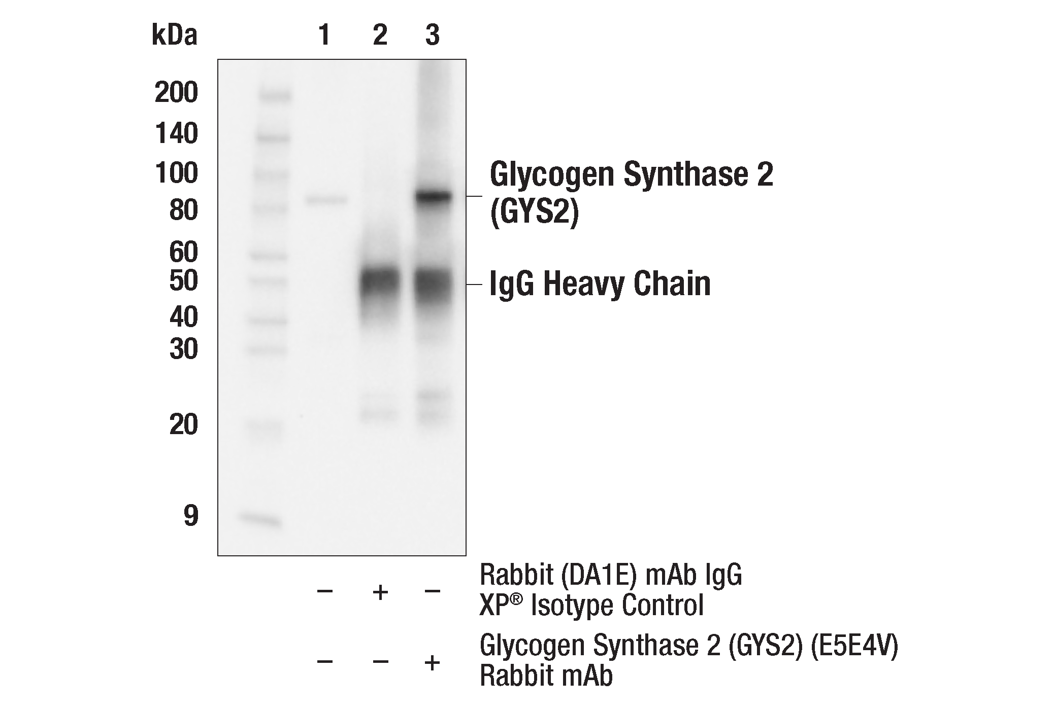 Immunoprecipitation Image 1: Glycogen Synthase 2 (GYS2) (E5E4V) Rabbit mAb