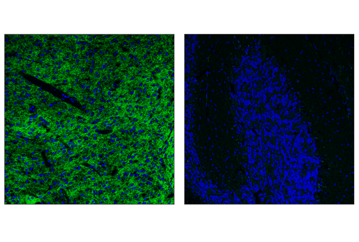Immunofluorescence Image 1: Dopamine D(2) Receptor/D2R (E1U8K) Rabbit mAb