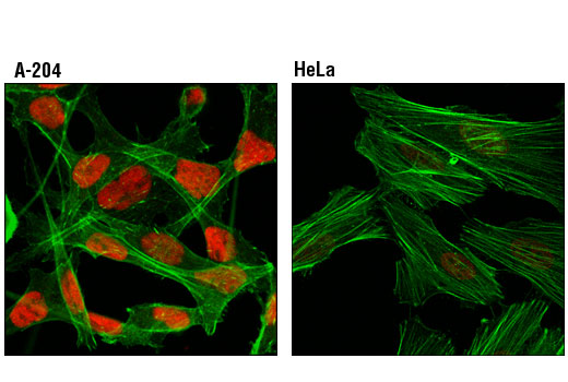 Immunofluorescence Image 1: Sox9 (D8G8H) Rabbit mAb (Alexa Fluor® 647 Conjugate)