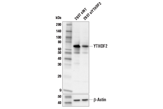 Image 10: N6-Methyladenosine (m6A) Binding Protein Antibody Sampler Kit