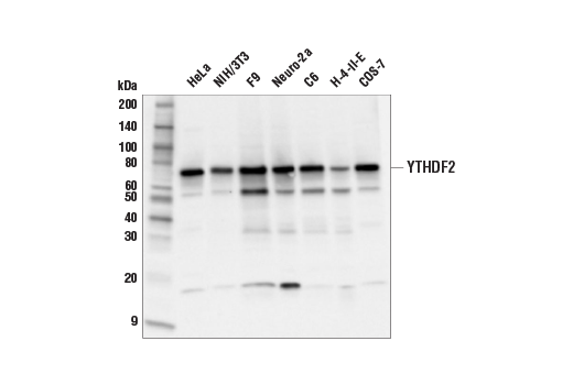  Image 22: N6-Methyladenosine (m6A) Binding Protein Antibody Sampler Kit