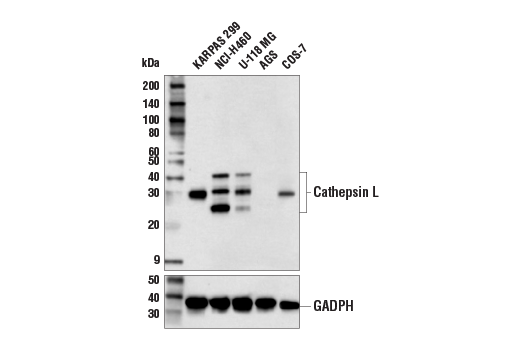 Western Blotting Image 1: Cathepsin L Antibody