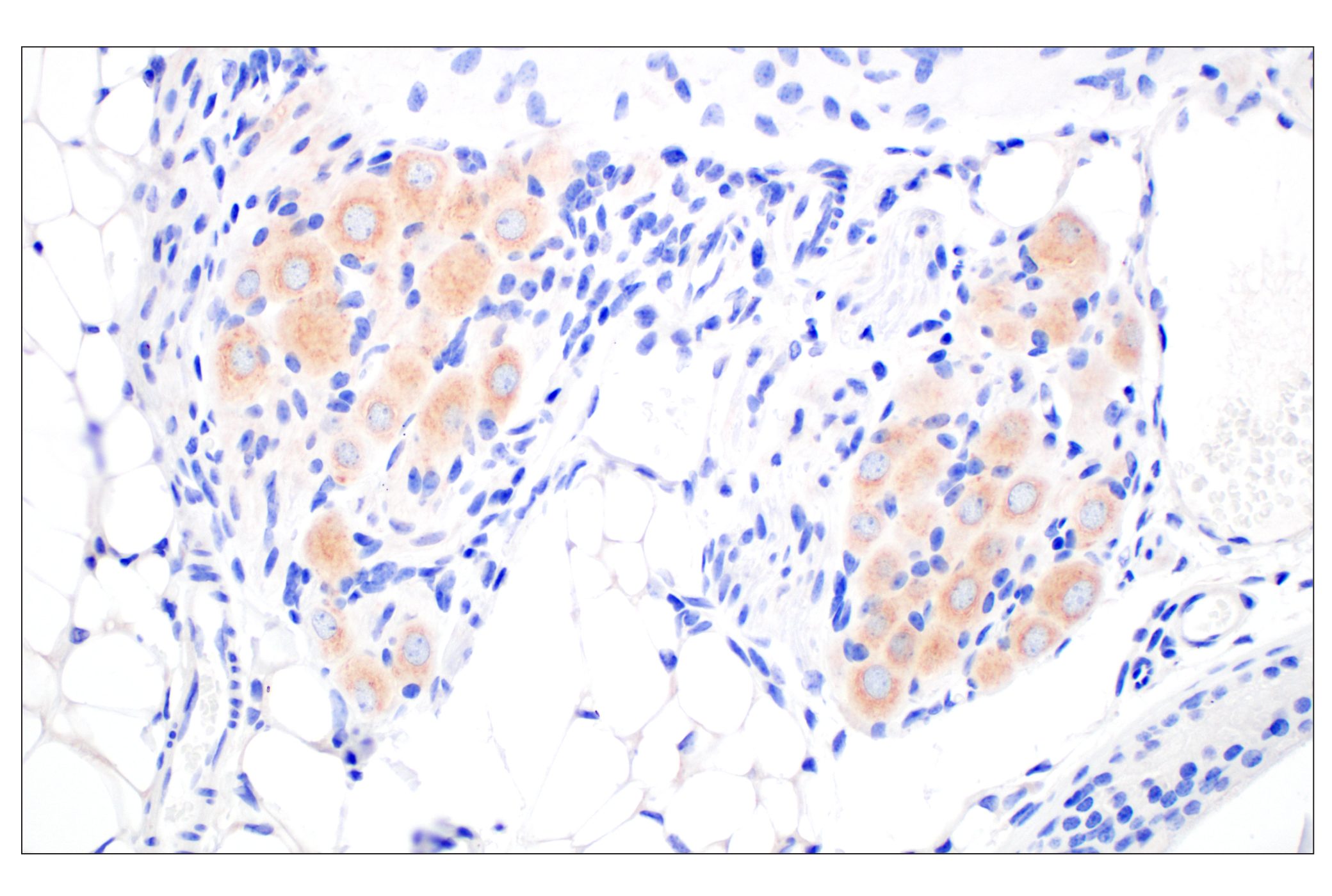Immunohistochemistry Image 5: BACE1 (F4Z7X) Rabbit mAb (BSA and Azide Free)