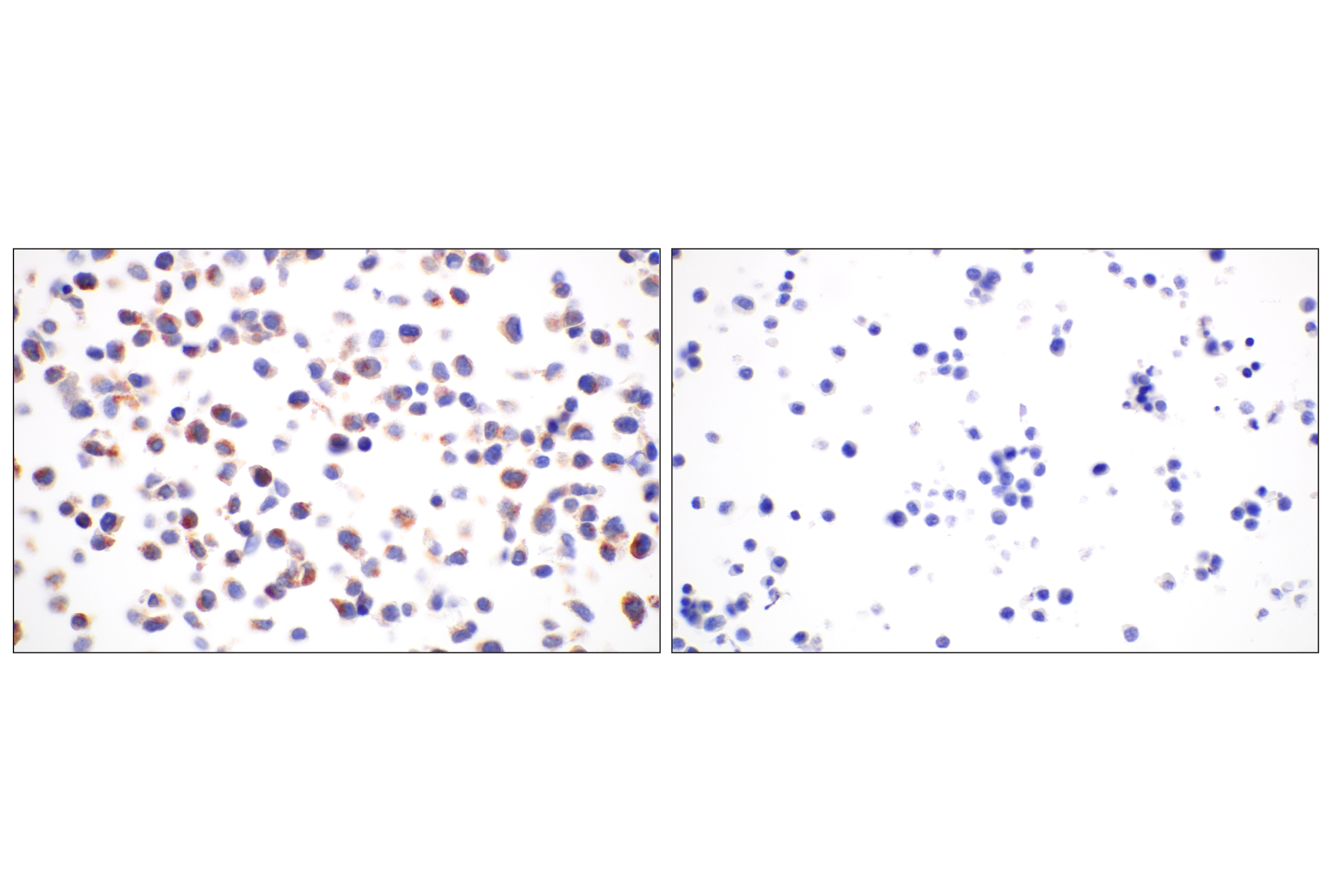 Immunohistochemistry Image 8: BACE1 (F4Z7X) Rabbit mAb (BSA and Azide Free)