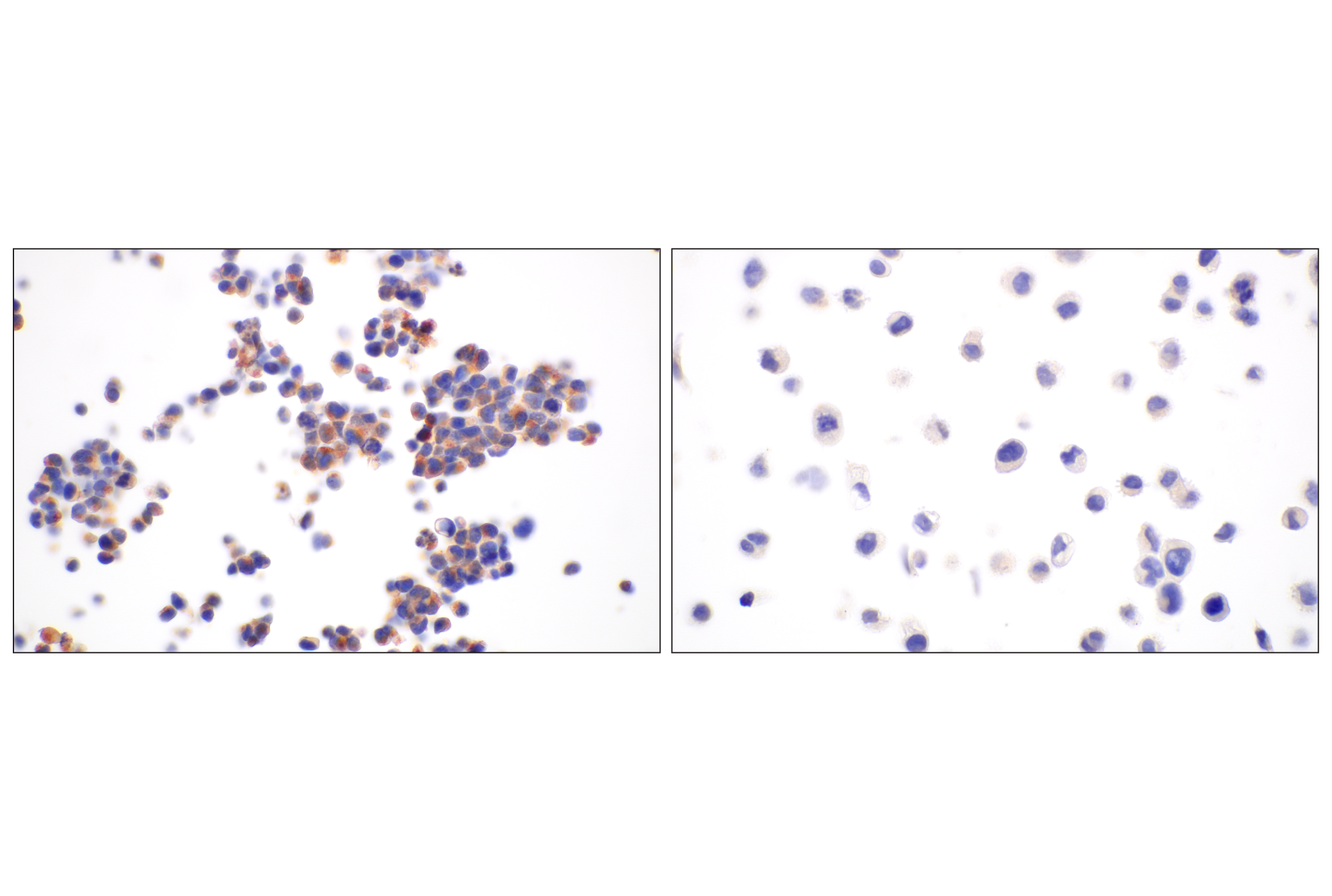 Immunohistochemistry Image 6: BACE1 (F4Z7X) Rabbit mAb (BSA and Azide Free)