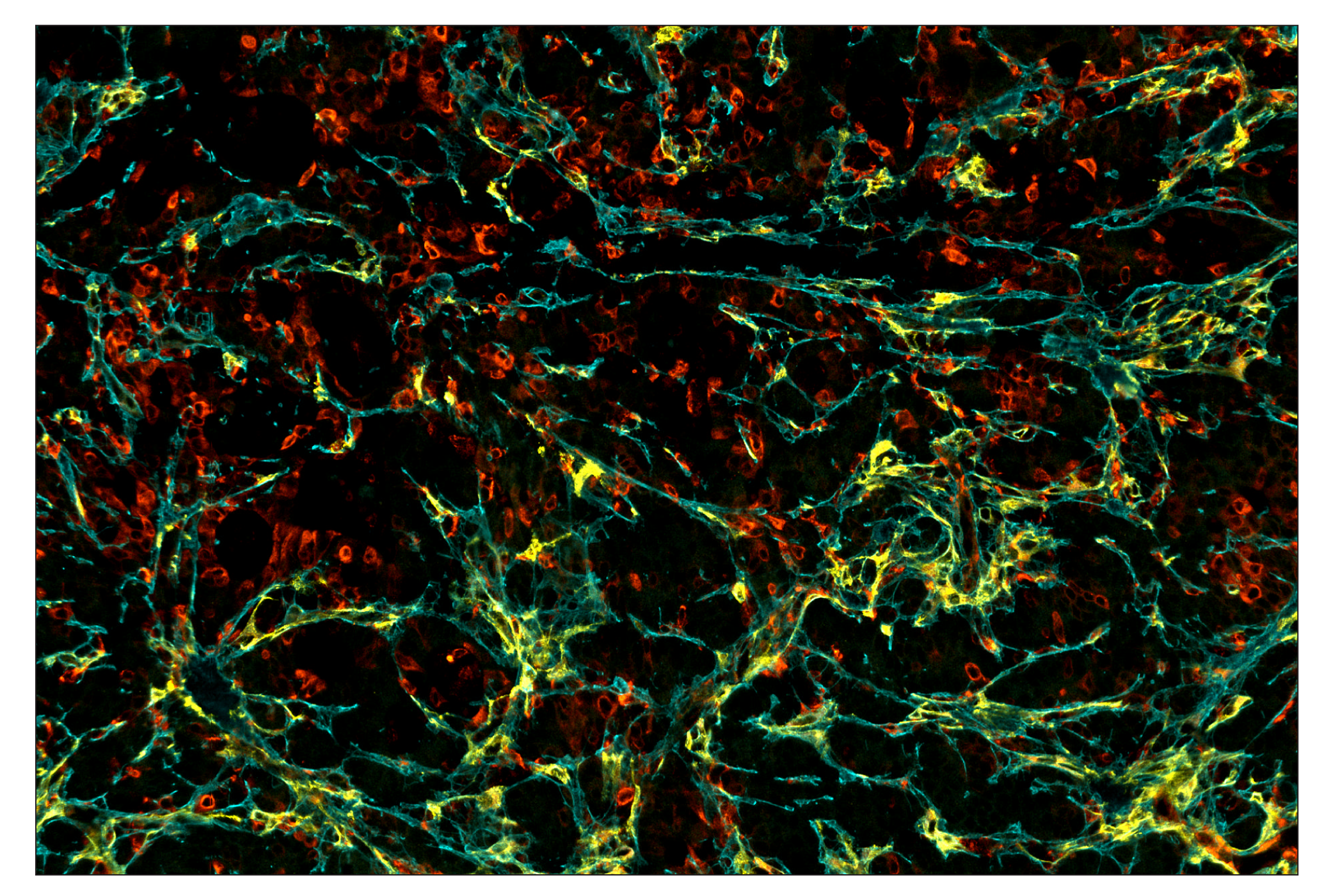 Immunohistochemistry Image 8: FAP (F1A4G) & CO-0116-594 SignalStar™ Oligo-Antibody Pair