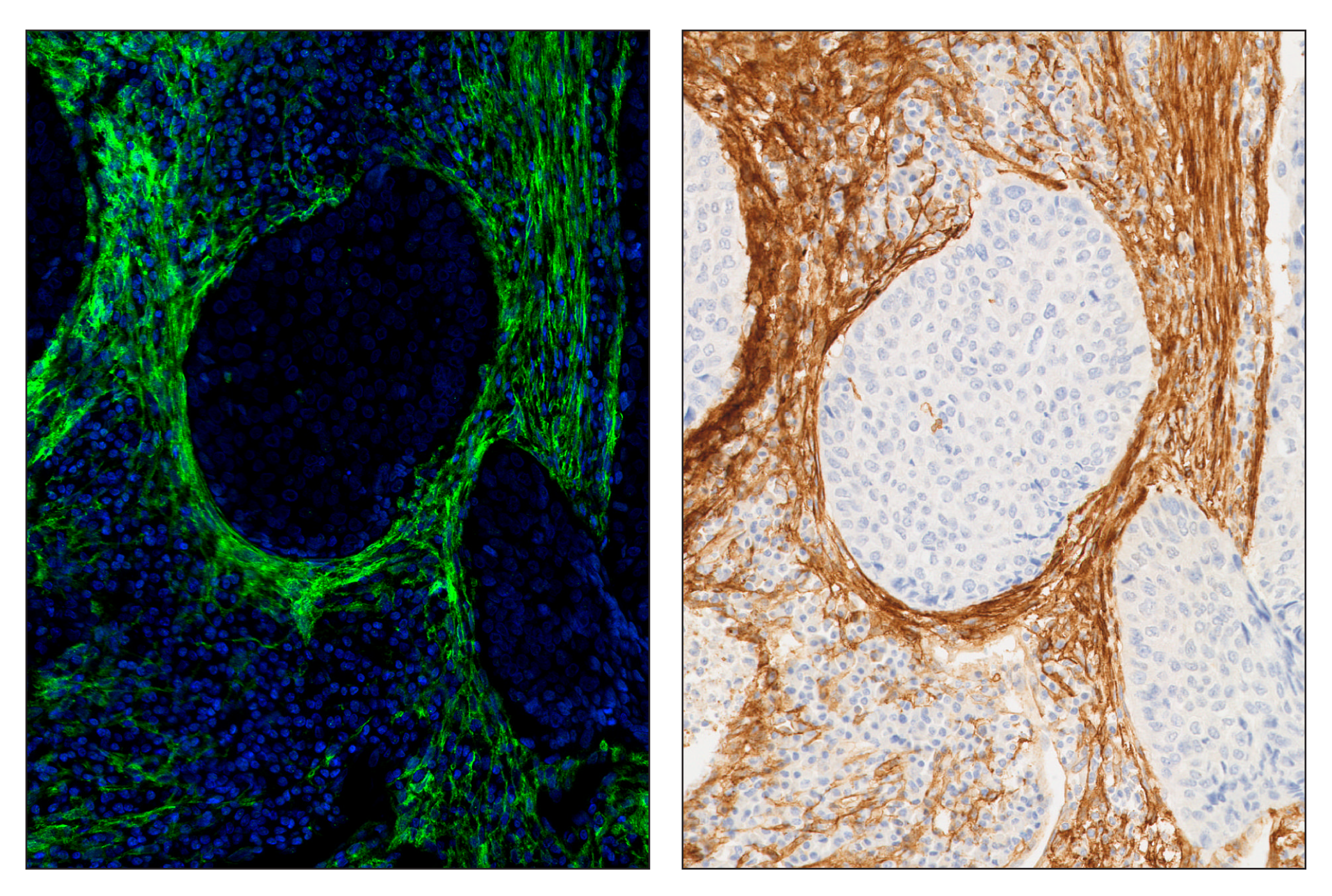 Immunohistochemistry Image 6: FAP (F1A4G) & CO-0116-594 SignalStar™ Oligo-Antibody Pair