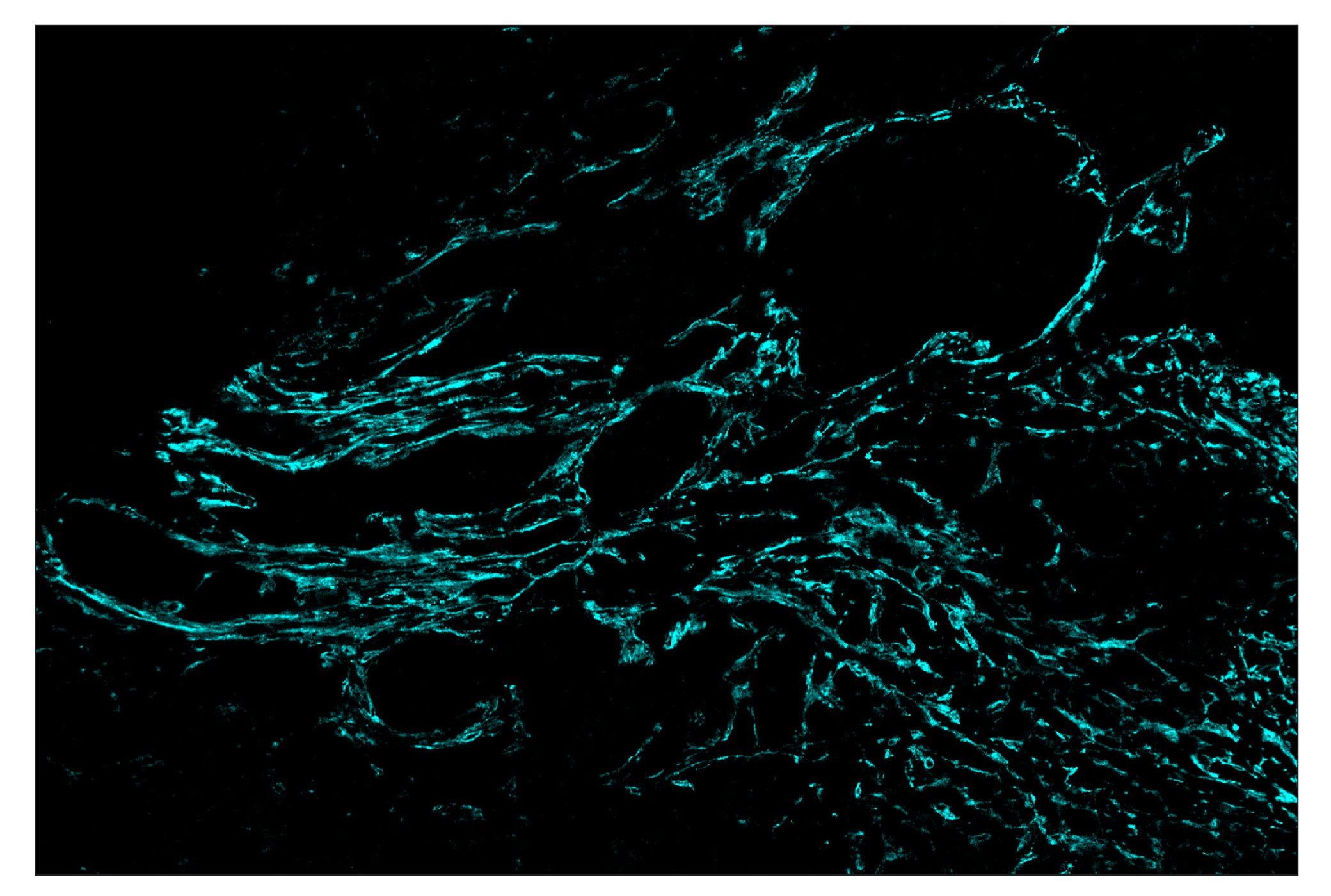 Immunohistochemistry Image 5: FAP (F1A4G) & CO-0116-594 SignalStar™ Oligo-Antibody Pair