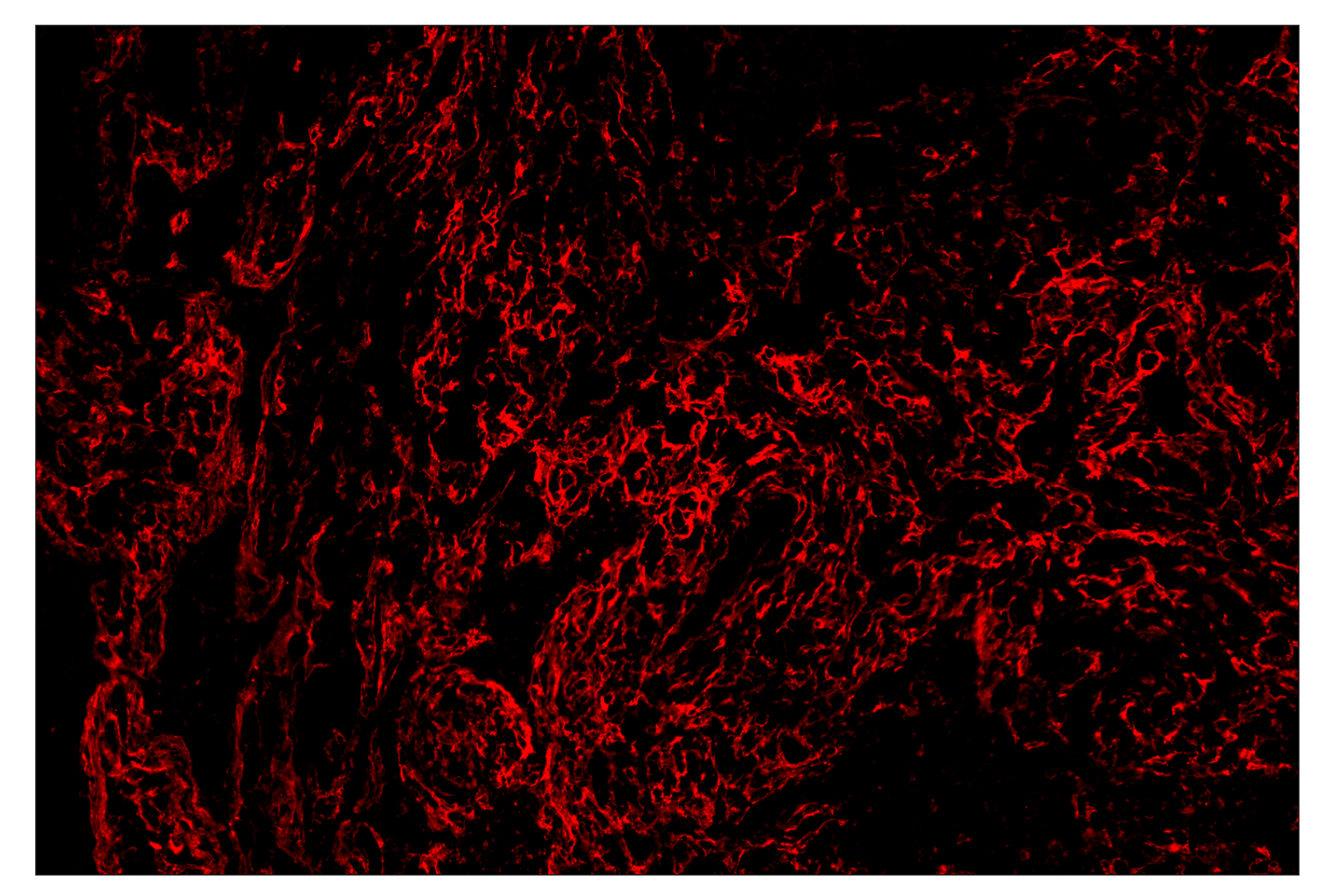 Immunohistochemistry Image 4: FAP (F1A4G) & CO-0116-594 SignalStar™ Oligo-Antibody Pair