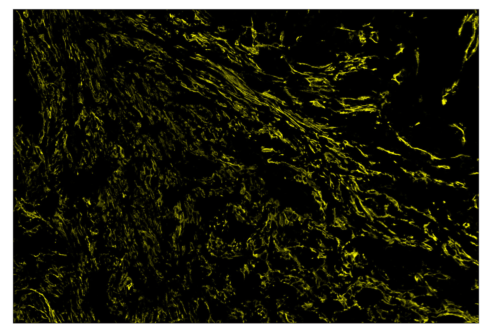 Immunohistochemistry Image 3: FAP (F1A4G) & CO-0116-594 SignalStar™ Oligo-Antibody Pair
