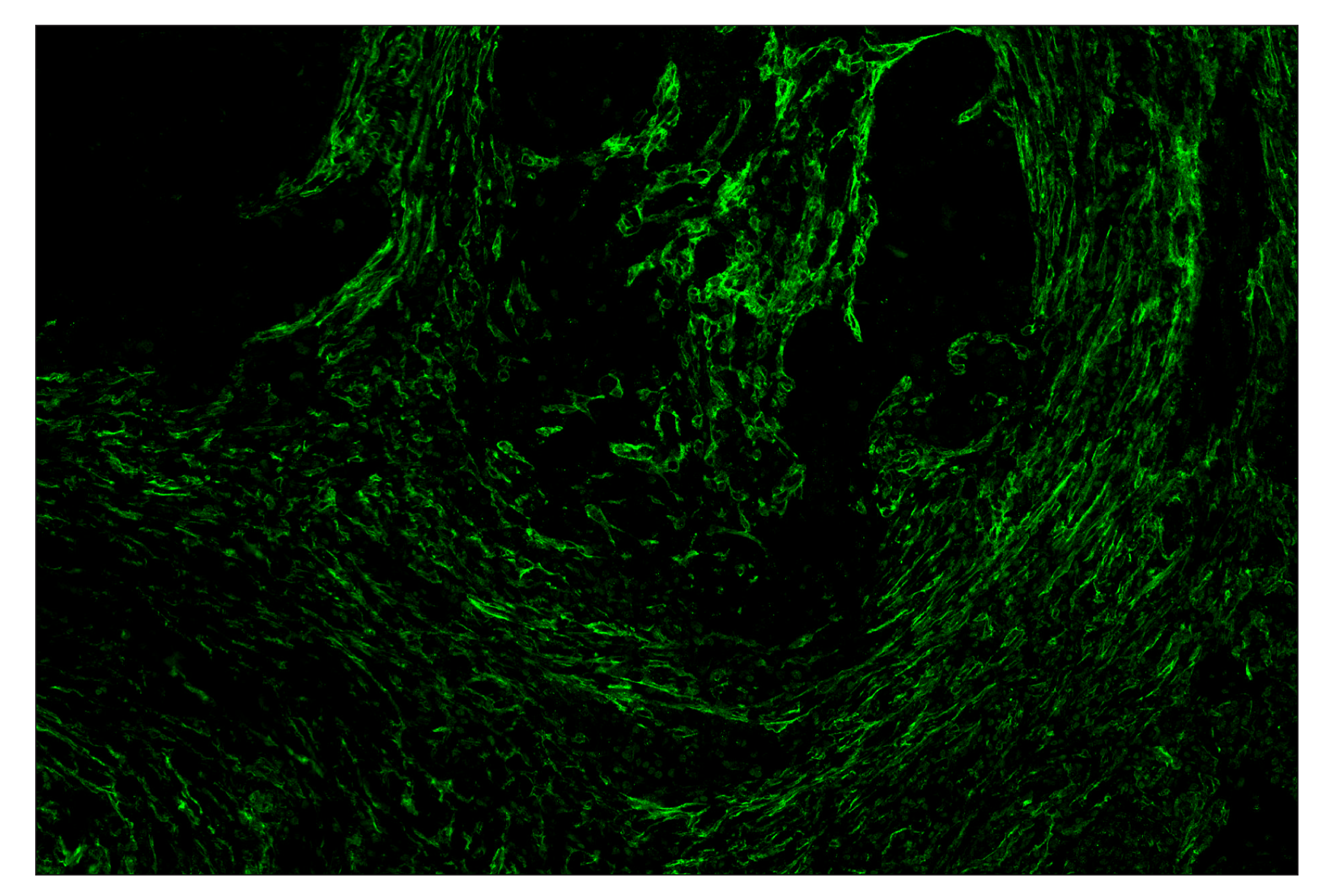 Immunohistochemistry Image 2: FAP (F1A4G) & CO-0116-594 SignalStar™ Oligo-Antibody Pair