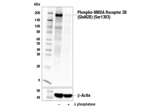 Western Blotting Image 1: Phospho-NMDA Receptor 2B (GluN2B) (Ser1303) Antibody