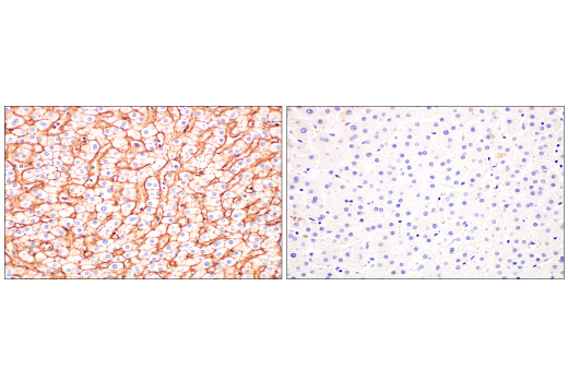 Immunohistochemistry Image 10: CD81 (D3N2D) Rabbit mAb (BSA and Azide Free)