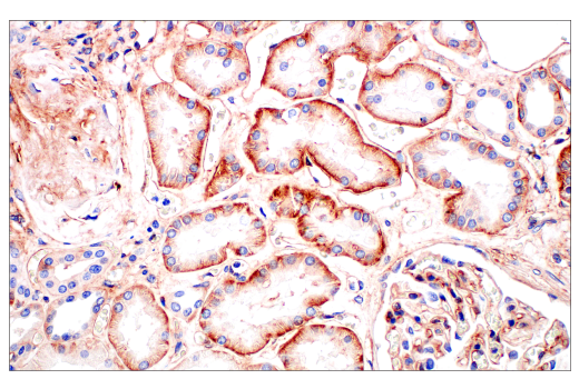 Immunohistochemistry Image 8: CD81 (D3N2D) Rabbit mAb (BSA and Azide Free)
