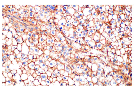 Immunohistochemistry Image 1: CD81 (D3N2D) Rabbit mAb (BSA and Azide Free)