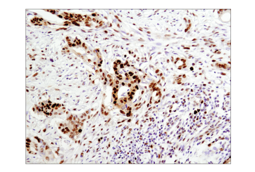 Immunohistochemistry Image 2: PCNA (D3H8P) XP® Rabbit mAb (BSA and Azide Free)