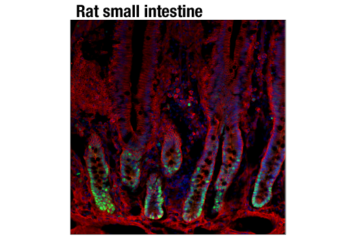 Immunofluorescence Image 1: PCNA (D3H8P) XP® Rabbit mAb (BSA and Azide Free)