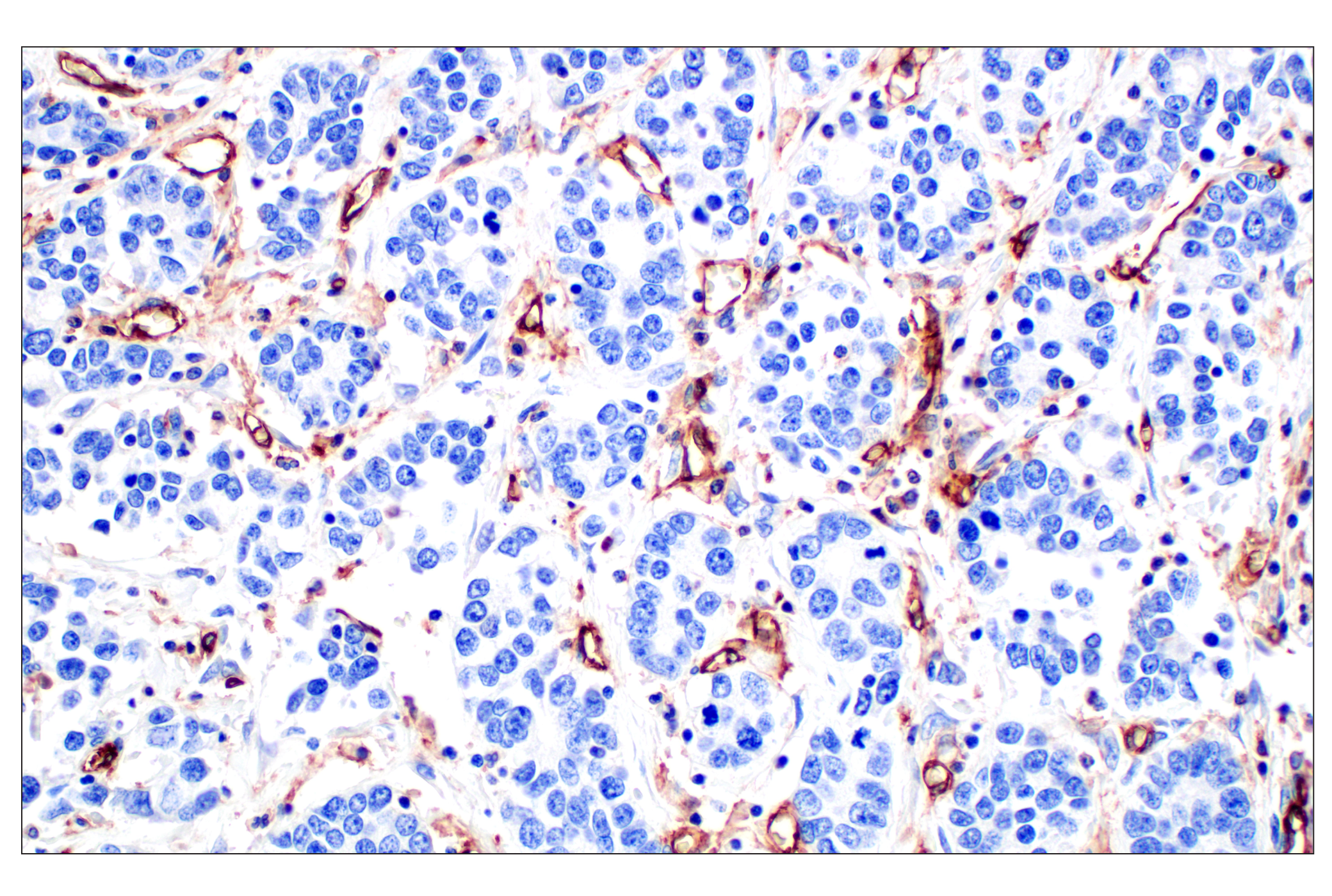 Immunohistochemistry Image 8: CD31 (PECAM-1) (F8M3S) Rabbit mAb (BSA and Azide Free)