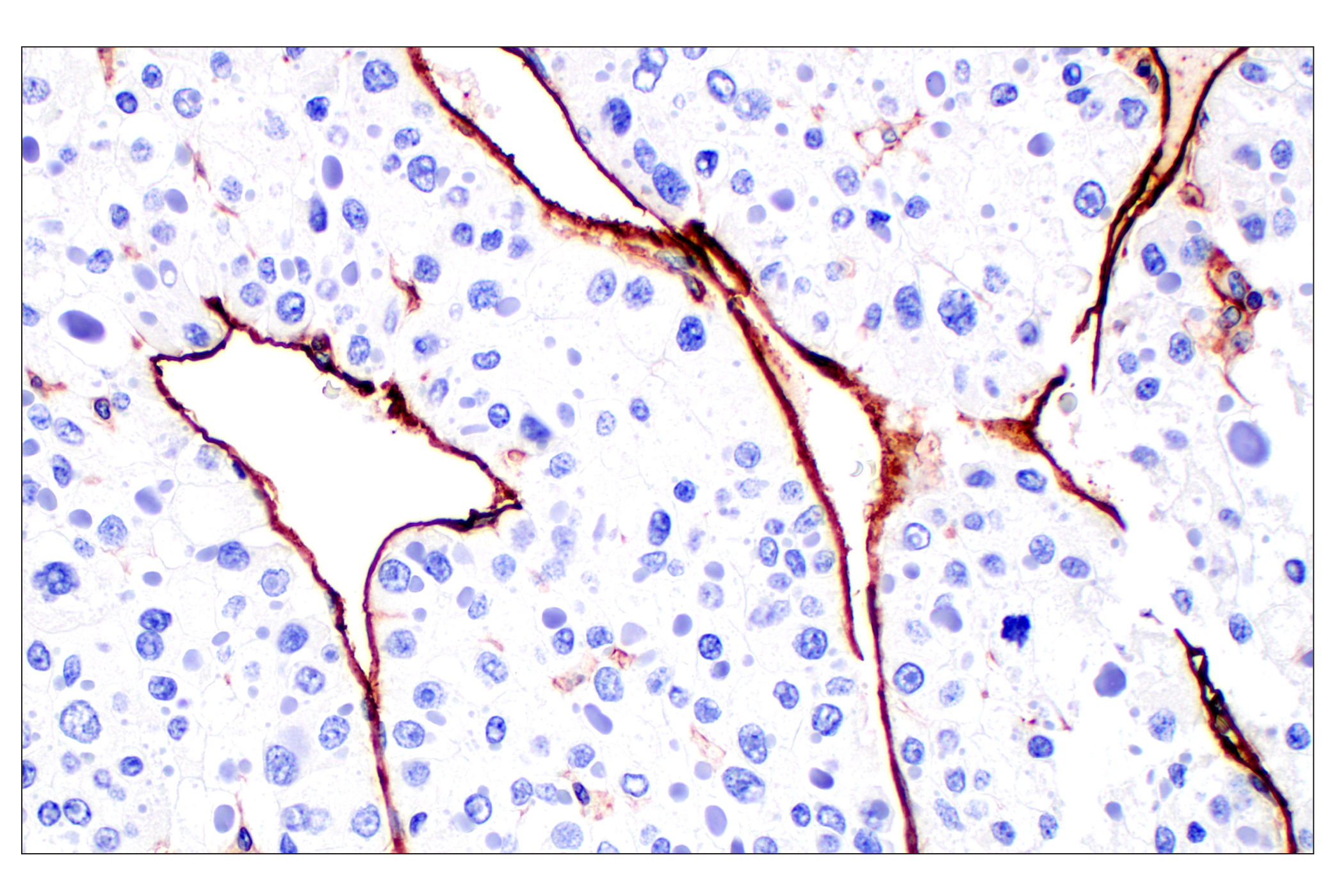 Immunohistochemistry Image 7: CD31 (PECAM-1) (F8M3S) Rabbit mAb (BSA and Azide Free)