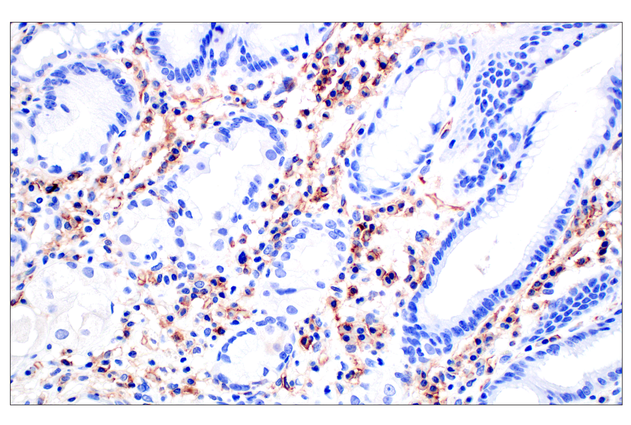 Immunohistochemistry Image 11: CD31 (PECAM-1) (F8M3S) Rabbit mAb (BSA and Azide Free)
