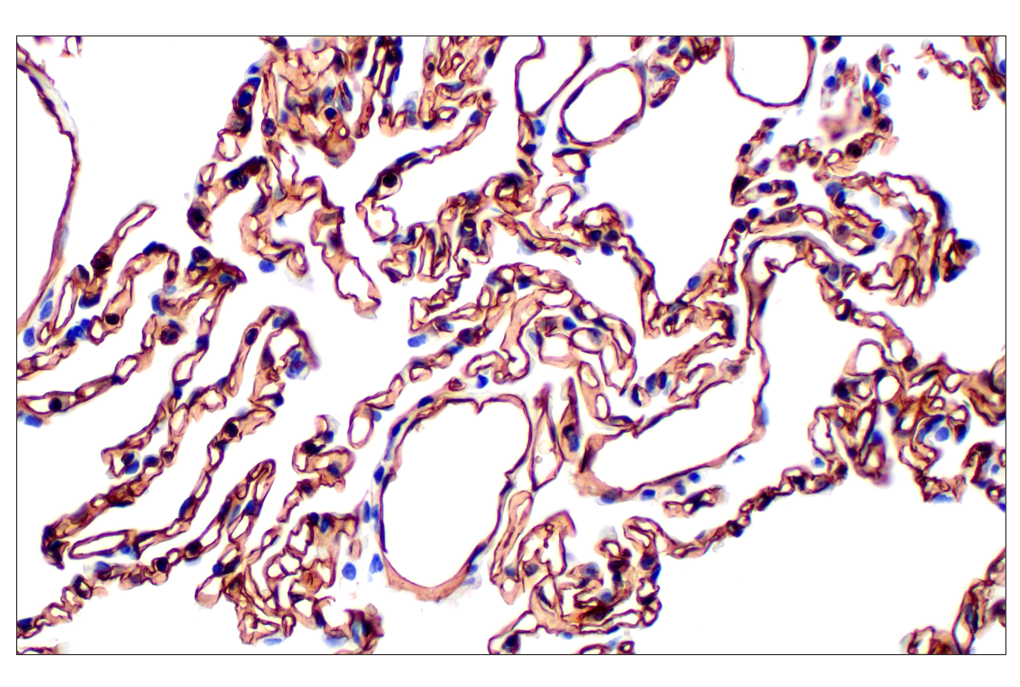 Immunohistochemistry Image 2: CD31 (PECAM-1) (F8M3S) Rabbit mAb (BSA and Azide Free)