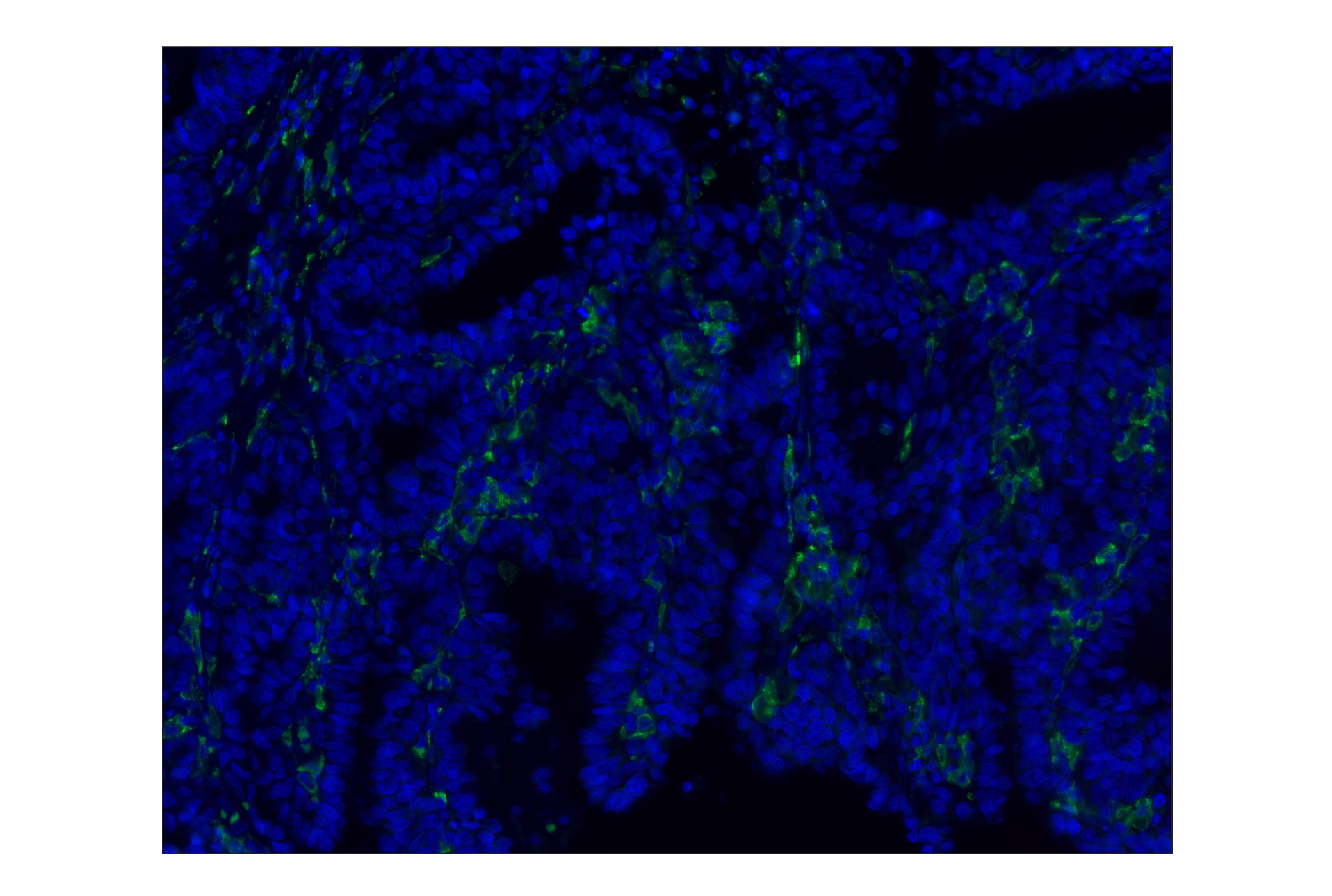 Immunohistochemistry Image 1: CD163 (D6U1J) Rabbit mAb (Alexa Fluor® 488 Conjugate)