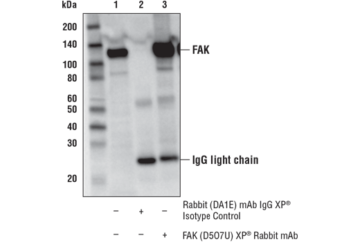 Immunoprecipitation Image 1: FAK (D5O7U) XP® Rabbit mAb