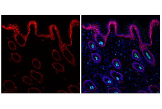 Immunofluorescence Image 1: Keratin 5 (E2T4B) XP® Rabbit mAb