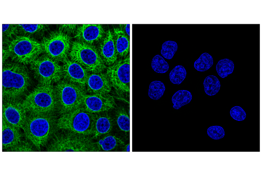 Immunofluorescence Image 2: Keratin 5 (E2T4B) XP® Rabbit mAb