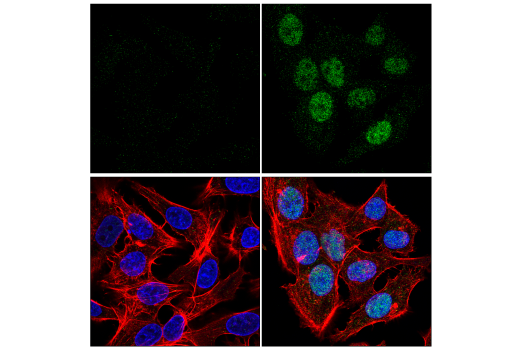 Immunofluorescence Image 1: HIF-2α (E8E5Z) Rabbit mAb