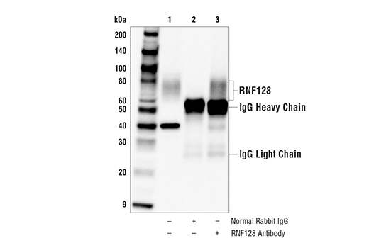 Immunoprecipitation Image 1: RNF128 Antibody