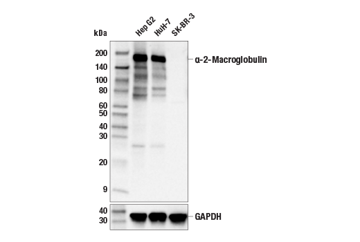 Western Blotting Image 1: α-2-Macroglobulin (E6N7X) Rabbit mAb