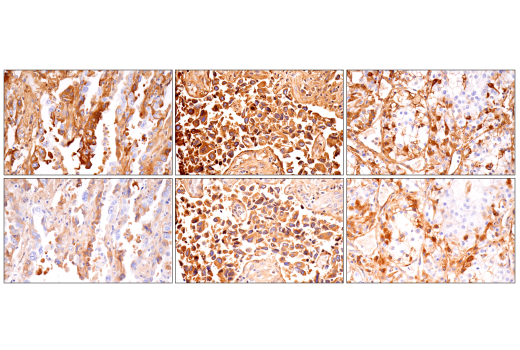 Immunohistochemistry Image 13: α-2-Macroglobulin (E6N7X) Rabbit mAb