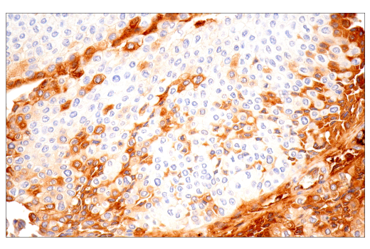 Immunohistochemistry Image 6: α-2-Macroglobulin (E6N7X) Rabbit mAb