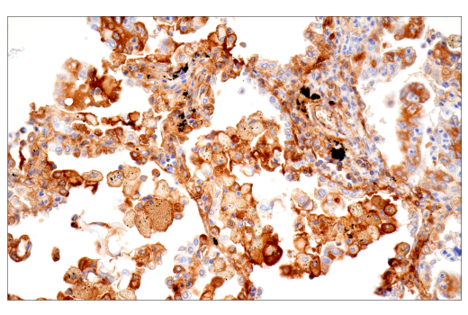 Immunohistochemistry Image 3: α-2-Macroglobulin (E6N7X) Rabbit mAb