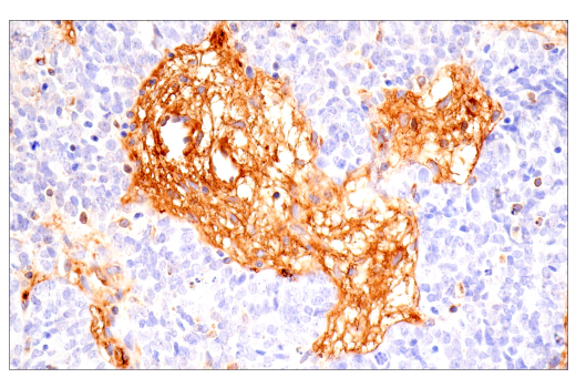 Immunohistochemistry Image 1: α-2-Macroglobulin (E6N7X) Rabbit mAb