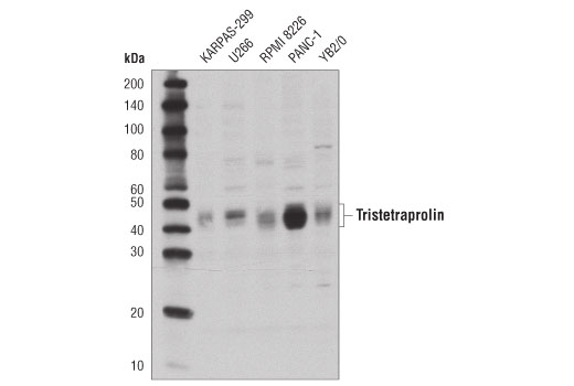 Western Blotting Image 1: Tristetraprolin (D1I3T) Rabbit mAb