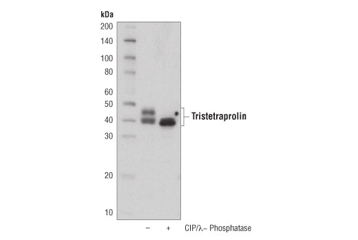 Western Blotting Image 2: Tristetraprolin (D1I3T) Rabbit mAb