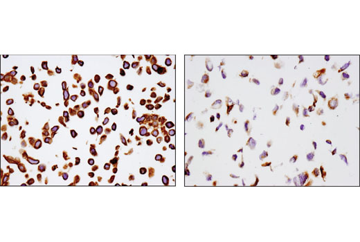 Immunohistochemistry Image 2: MRP4/ABCC4 (D1Z3W) Rabbit mAb (BSA and Azide Free)
