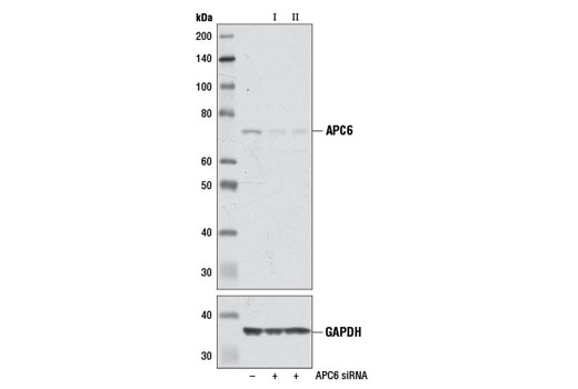  Image 1: SignalSilence® APC6 siRNA II