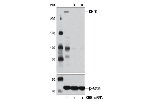  Image 1: SignalSilence® CHD1 siRNA I